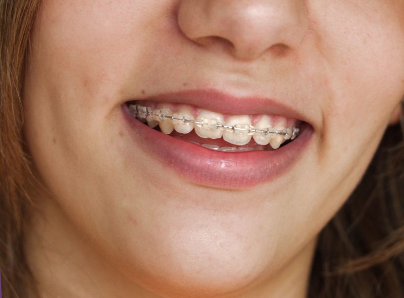 Orthodontics In Medina OH For All Stages Of Life